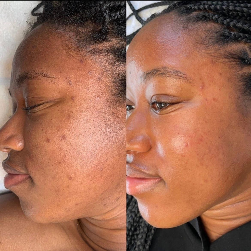 Fade Serum